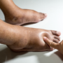7 Science-Backed Ways How to Get Rid of Fluid Retention That Actually Work (Even If You’ve Tried Everything)